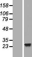 EFCAB1 Human Over-expression Lysate