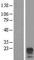 TMEM204 Human Over-expression Lysate