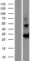 OGFOD2 Human Over-expression Lysate
