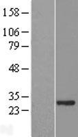 ASB7 Human Over-expression Lysate
