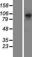 IQCA1 Human Over-expression Lysate