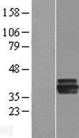 AGMAT Human Over-expression Lysate