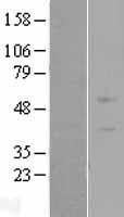 ZNF669 Human Over-expression Lysate