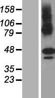 ZDHHC11 Human Over-expression Lysate