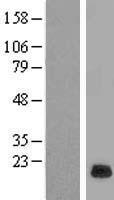 RPP21 Human Over-expression Lysate