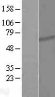 TTC26 Human Over-expression Lysate