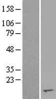 RPS2P45 Human Over-expression Lysate