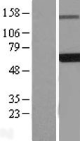 EDC3 Human Over-expression Lysate
