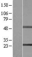 SIKE1 Human Over-expression Lysate
