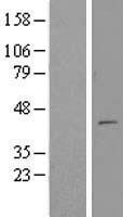 MTERF2 Human Over-expression Lysate