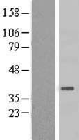 HSD3B7 Human Over-expression Lysate