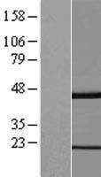 GKAP1 Human Over-expression Lysate