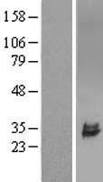 ULBP2 Human Over-expression Lysate