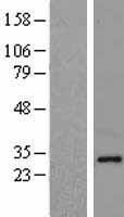NDFIP1 Human Over-expression Lysate
