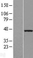 ZSCAN16 Human Over-expression Lysate