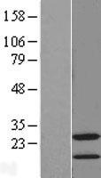 STMN4 Human Over-expression Lysate