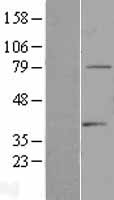 TDRD3 Human Over-expression Lysate