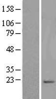 SYNC Human Over-expression Lysate