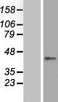 ZNF696 Human Over-expression Lysate