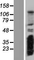 CPLANE2 Human Over-expression Lysate