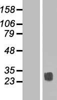 TSPAN14 Human Over-expression Lysate