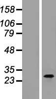 CTRP3 (C1QTNF3) Human Over-expression Lysate