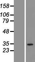 QTRT1 Human Over-expression Lysate