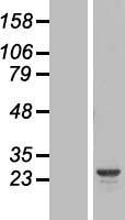 HYI Human Over-expression Lysate