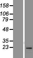 RAB1B Human Over-expression Lysate