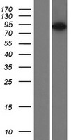 Espin (ESPN) Human Over-expression Lysate