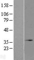 MRO Human Over-expression Lysate