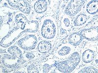 Goat anti-HOXA10 Antibody