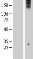 WDR75 Human Over-expression Lysate