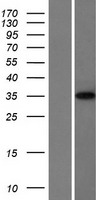 LARP2 (LARP1B) Human Over-expression Lysate