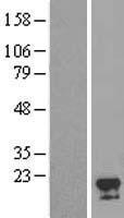 CIAO2A Human Over-expression Lysate