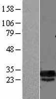 DCUN1D5 Human Over-expression Lysate