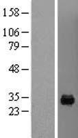 MAF1 Human Over-expression Lysate