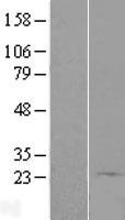 C9orf89 (CARD19) Human Over-expression Lysate