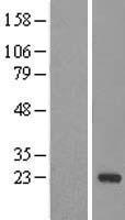 DCTN5 Human Over-expression Lysate