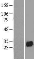 NTAL (LAT2) Human Over-expression Lysate