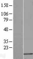 C14orf142 (GON7) Human Over-expression Lysate
