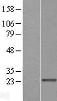 CYorf15B Human Over-expression Lysate