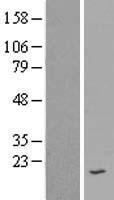 SPINK7 Human Over-expression Lysate