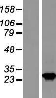 RAB2B Human Over-expression Lysate