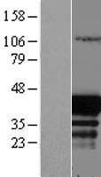 EAF1 Human Over-expression Lysate