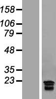 hCG beta (CGB7) Human Over-expression Lysate