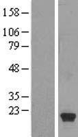 b9HSP (HSPB9) Human Over-expression Lysate