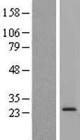 RPL13 Human Over-expression Lysate