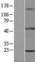 RNF93 (TRIM15) Human Over-expression Lysate