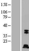 Caspase-7 (CASP7) Human Over-expression Lysate